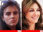 elizabeth-hurley-before-after-surgery.jpg