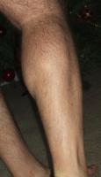 rleg.JPG