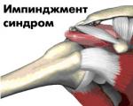 sindrom.jpg